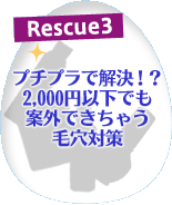 Rescue3�@�v�`�v���ŉ����I�H�@2,000�~�ȉ��ł��ĊO�ł����Ⴄ�ь��΍�